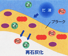 再石灰化（さいせっかいか）